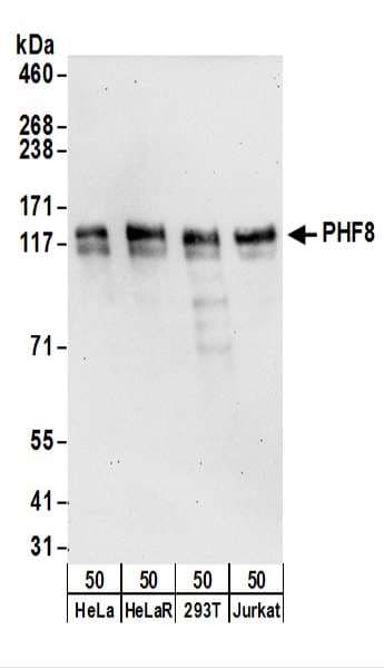 PHF8 Antibody (aa925-975)