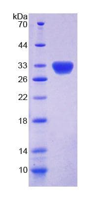 Rat DKC1 / Dyskerin Protein (Recombinant His-T7)