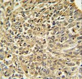 NF2 / Merlin Antibody (aa65-95)