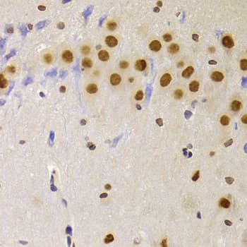 Polyclonal Rabbit anti-Human HNRPA1 / HnRNP A1 Antibody (IHC, IF, WB)