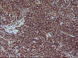 Placental Lactogen Antibody (clone OTI2G4)