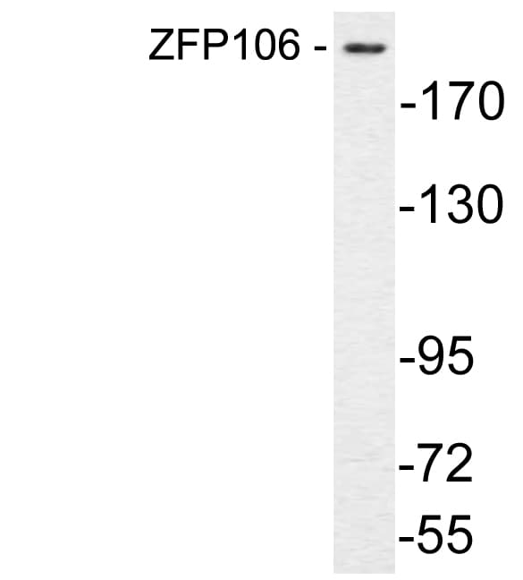 ZNF106 / ZFP106 Antibody (aa1833-1882)