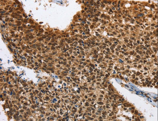 Polyclonal Rabbit anti-Human ELAVL1 / HUR Antibody (IHC, WB)