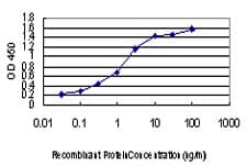 ACVR1B / ALK4 Antibody (clone 2D4)