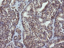 MAPK9 / JNK2 Antibody (clone OTI2H3)