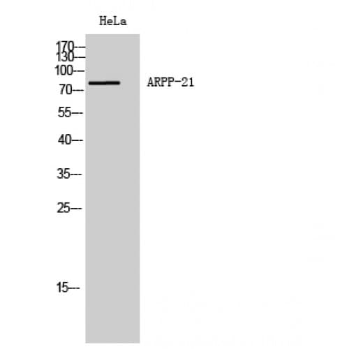 RCS / ARPP-21 Antibody (180-260 aa, Internal)