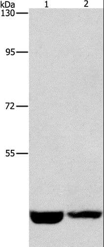 Polyclonal Rabbit anti-Human CSNK1E / CK1 Epsilon Antibody (IHC, WB)