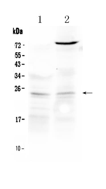 TIMP3 Antibody