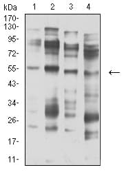 Monoclonal Mouse anti-Human CHRNA5 Antibody (clone 2D2D10, WB)