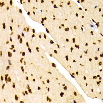 Histone H3 Antibody (Dimethyl-Lys27)