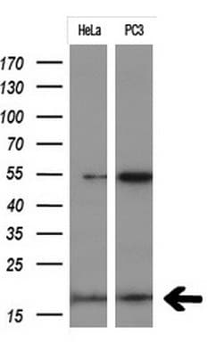 Monoclonal Mouse anti-Human p16INK4a / CDKN2A Antibody (clone OTI8E9, Carrier-free, IF, WB)