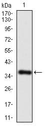 IHC-plus™ IL3RA / CD123 Antibody (aa200-305, clone 10B8E7)
