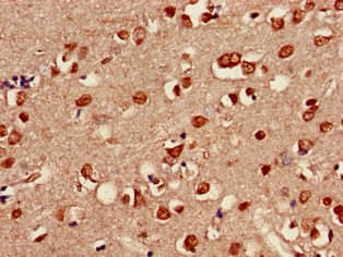SHOC2 Antibody