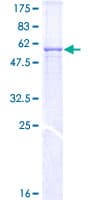 Human MPPE1 / PGAP5 Protein (Recombinant GST)
