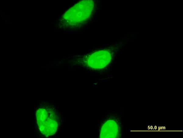 ALX1 Antibody (clone 2A10)
