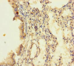 Polyclonal Rabbit anti-Human DUS4L Antibody