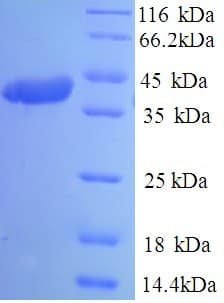 Human Coronavirus OC43 SARS-CoV Spike Glycoprotein (Recombinant 6His, N-terminus)