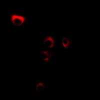 Polyclonal Rabbit anti-Human FDFT1 / Squalene Synthase Antibody (IF, WB)