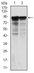 Monoclonal Mouse anti-Human NF-L / NEFL Antibody (clone 1H3, IHC, IF, WB)