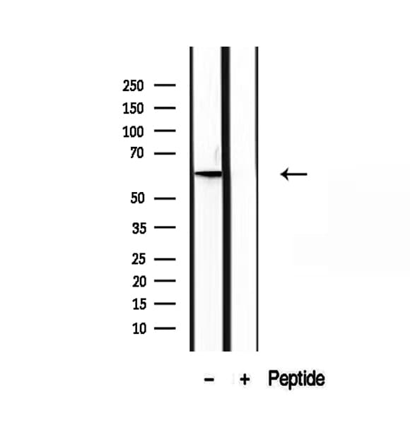 Polyclonal Rabbit anti-Human PIP5K1A Antibody (IHC, WB)