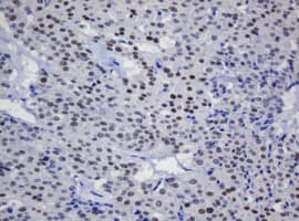 TRMT2A Antibody (clone OTI2A1)