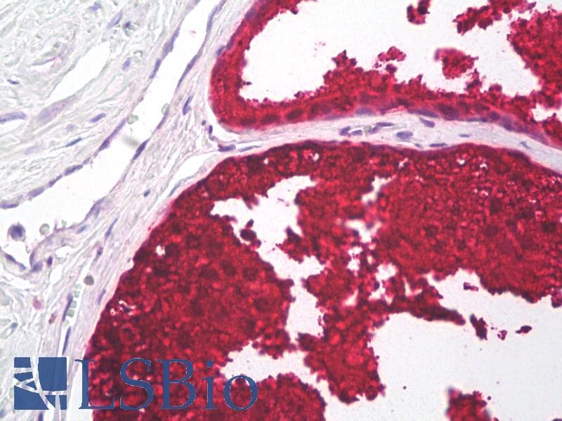 PathPlus™ Monoclonal Mouse-Balb/c anti-Human KLK3 / PSA Antibody (clone 1A7, IHC)