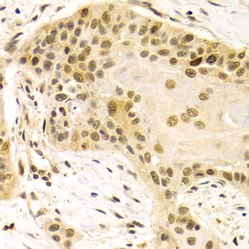 HURP / DLGAP5 Antibody