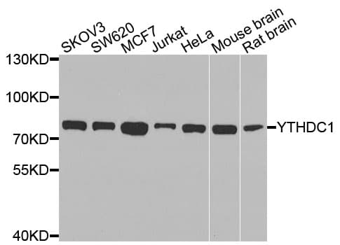 YTHDC1 Antibody