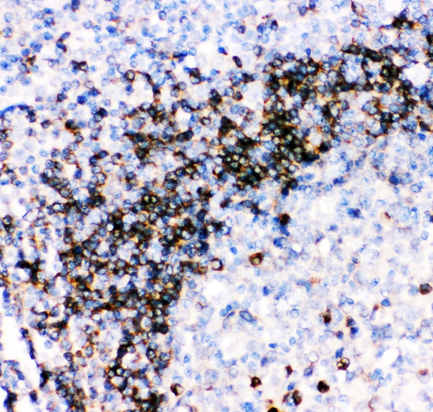 CD79A / CD79 Alpha Antibody (aa121-226)