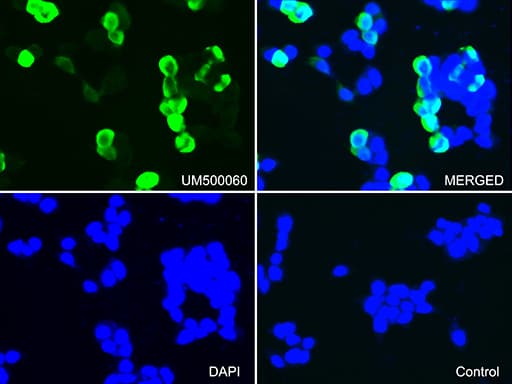 Monoclonal Mouse anti-Human CTAG1B / NY-ESO-1 Antibody (clone UMAB72, IHC, IF, WB)