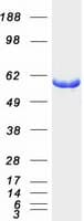 Human PHGDH Protein (Recombinant Myc-DDK (Flag))