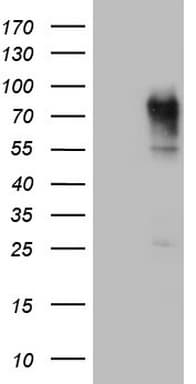 CEACAM5 / CD66e Antibody (aa35-680, clone OTI2B12)