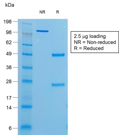 Recombinant Monoclonal Mouse anti-Human TG / Thyroglobulin Antibody (clone r6E1, Azide-free,Carrier-free, IHC)