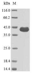 Pseudomonas aeruginosa ompF Protein (Recombinant 6His, N-terminus)