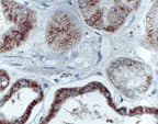 BIK Antibody