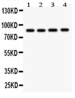 Polyclonal Rabbit anti-Human NOX5 Antibody (aa747-765, IHC, WB)