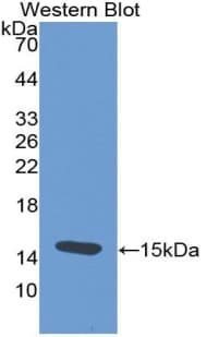 TSHB / TSH-Beta Antibody (aa21-138)
