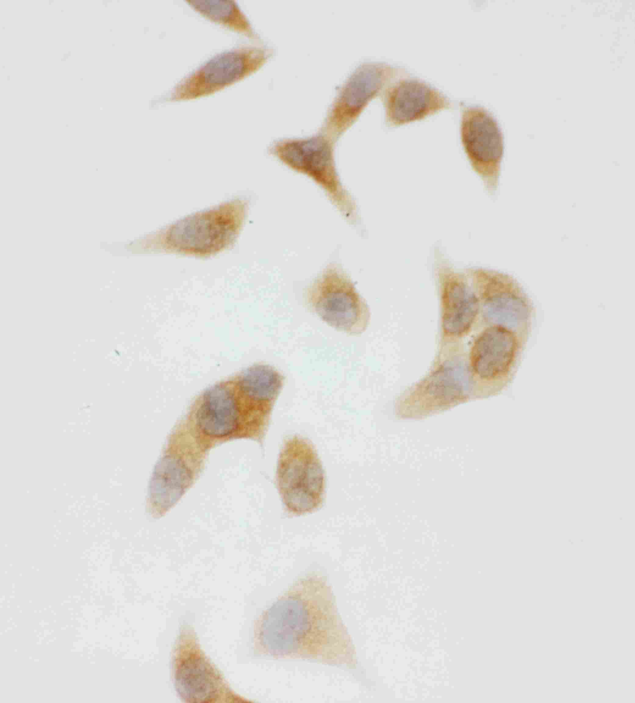 Polyclonal Rabbit anti-Human CYP2U1 Antibody (aa457-473, IHC, WB)