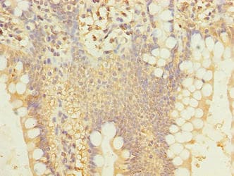 Polyclonal Rabbit anti-Human SIPA1L2 Antibody (IHC)