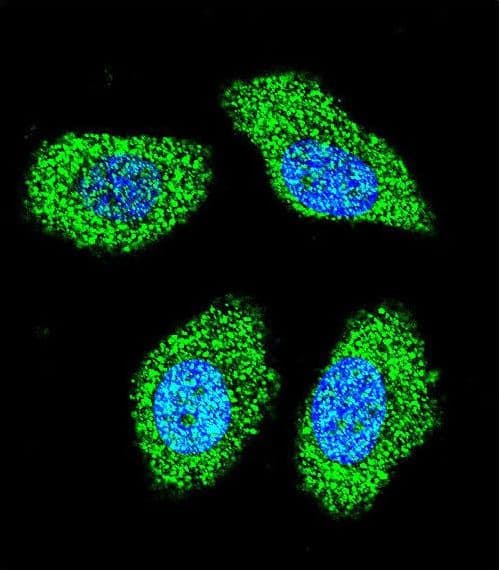 Polyclonal Rabbit anti-Human IER3 / IEX-1 Antibody (aa38-65, IHC, IF, WB)