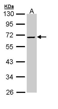 IHC-plus™ SERPINF2 / Alpha-2-Antiplasmin Antibody (aa188-453)