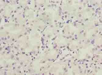 LRRC20 Antibody