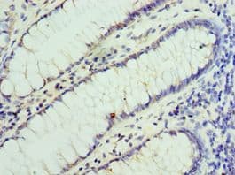 VENTX Antibody (aa1-258)