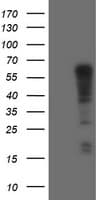Monoclonal Mouse anti-Human SPRING / TRIM9 Antibody (clone OTI2A1, WB)