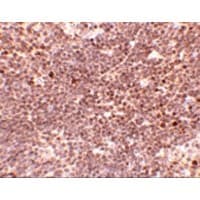 S1PR1 / EDG1 / S1P1 Antibody
