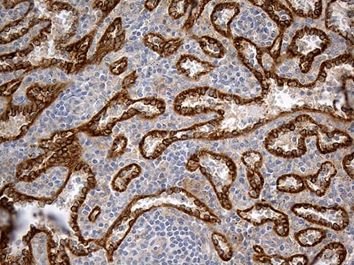 Monoclonal Mouse anti-Human HOMER1 / Homer 1 Antibody (clone OTI7G10, aa1-354, IHC, WB)