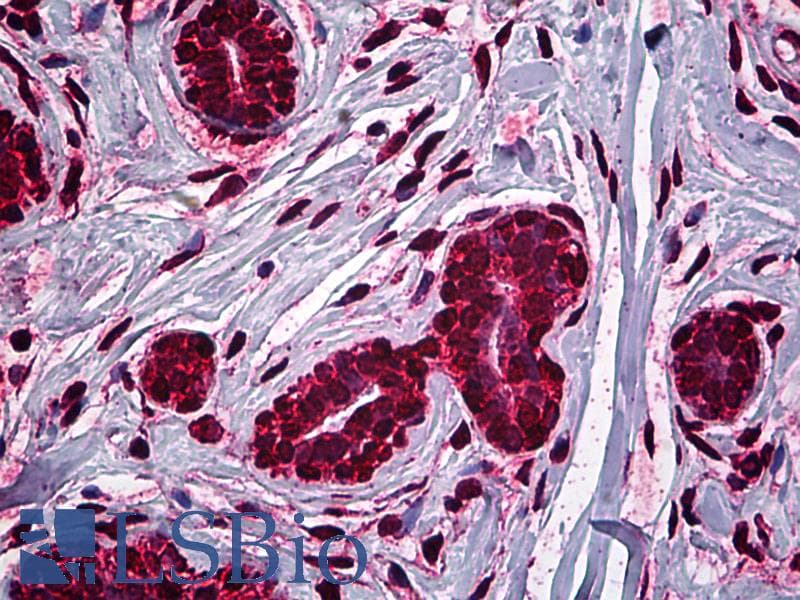 IHC-plus™ Monoclonal Mouse anti-Human MDM2 Antibody (clone 1A7, IHC, WB)