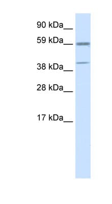 Polyclonal Rabbit anti-Mouse ATF4 Antibody (N-Terminus, IHC, WB)