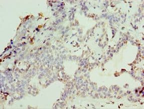 NCL / Nucleolin Antibody (aa411-710)