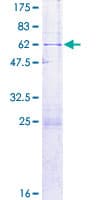 Human C22orf31 Protein (Recombinant GST)